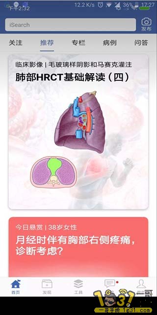 173418n8xqyx2ycinaic9v.jpg